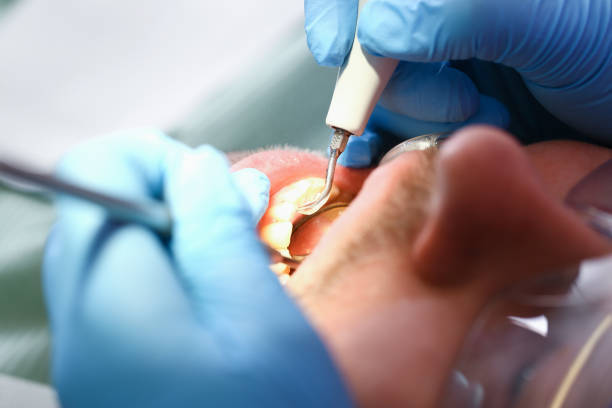 Best Walk-In Emergency Dentist in La Honda, CA